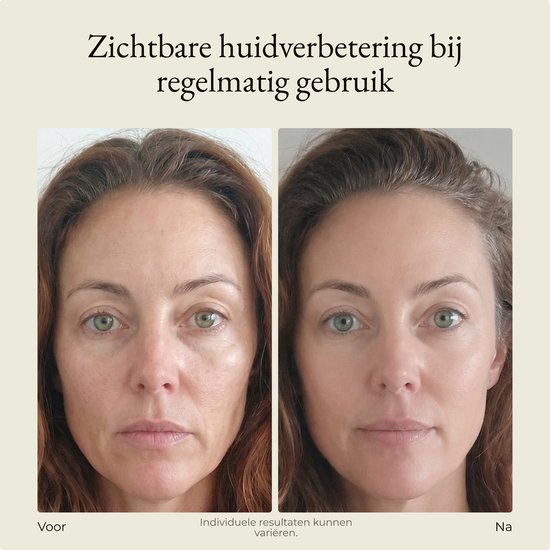 Maxi Meilleur® Nova Series Full Set - Rood & Nabij infrarood - led gezichtsmasker lichttherapie - Anti-aging LED masker met rood licht therapie - Led Face mask - infrarood masker - led masker lichttherapie - Red Light therapy mask