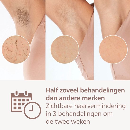 Philips Lumea IPL 9900 Series - IPL Ontharingsapparaat - AI haarvermindering analyse - 4 opzetstukken met trimmer - BRP959/00