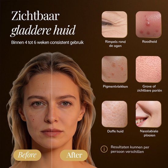 Frasco Glow Pro® LED Masker - Red Light Therapy - Collageen Masker - Huidverjongingsapparaat - 8 Standen